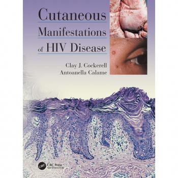 Vitalsource Technologies, Inc. Cutaneous Manifestations Of Hiv Disease