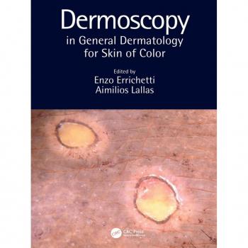 Vitalsource Technologies, Inc. Dermoscopy In General Dermatology For Skin Of Color