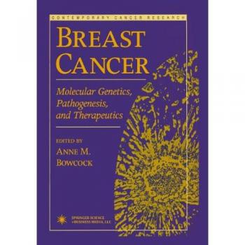 Breast Cancer