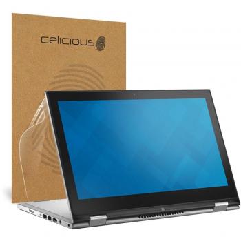 GuardianFlex – Dell Inspiron 17 i7746 Shock‑Resistant Film