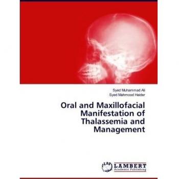 Oral and Maxillofacial Manifestation of Thalassemia and Management