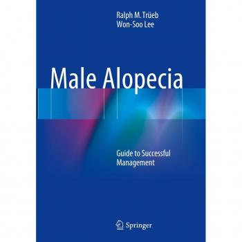 Male Alopecia