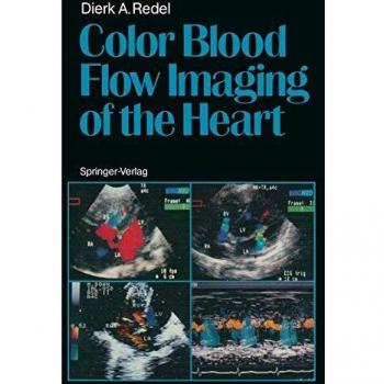 Color Blood Flow Imaging of the Heart