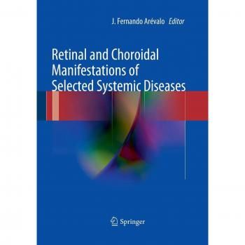 Retinal and Choroidal Manifestations of Selected Systemic Diseases