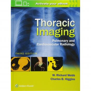Thoracic Imaging
