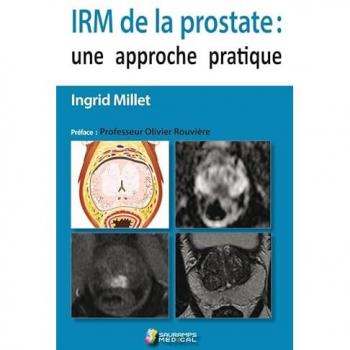 Irm de la prostate : une approche pratique