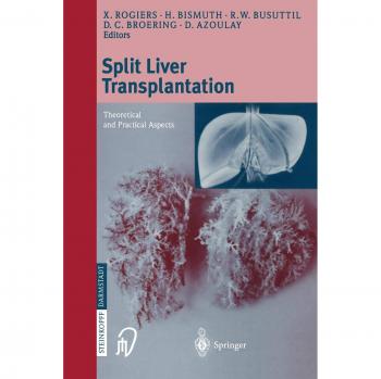 Split liver transplantation