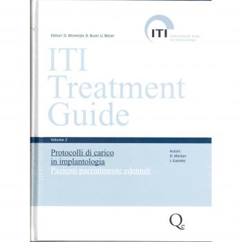 Iti treatment guide. Protocollo di carico nell'odontoiatria implantare per pazienti con edentulia parziale (Vol. 2)