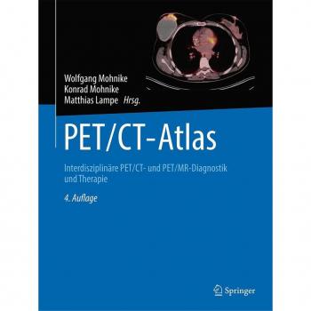 PET/CT-Atlas