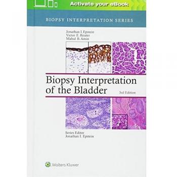 Biopsy Interpretation of the Bladder (Biopsy Interpretation Series)
