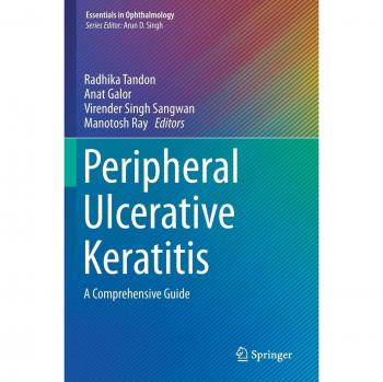 Peripheral Ulcerative Keratitis: A Comprehensive Guide