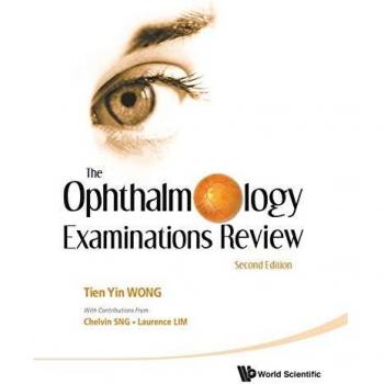 The Ophthalmology Examinations Review