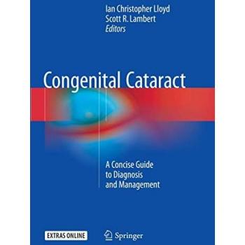 Congenital Cataract: A Concise Guide to Diagnosis and Management