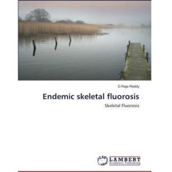 Endemic skeletal fluorosis: Skeletal Fluorosis