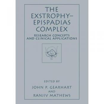 The Exstrophy―Epispadias Complex: Research Concepts and Clinical Applications