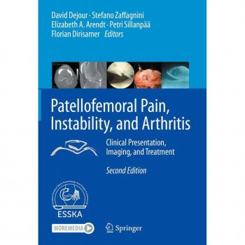 Patellofemoral Pain Instability and Arthritis