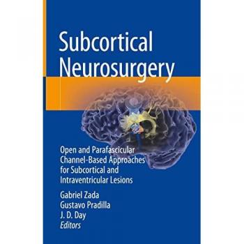 Subcortical Neurosurgery