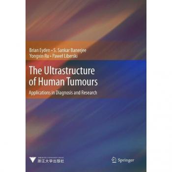 Vitalsource Technologies, Inc. Ultrastructure Of Human Tumours