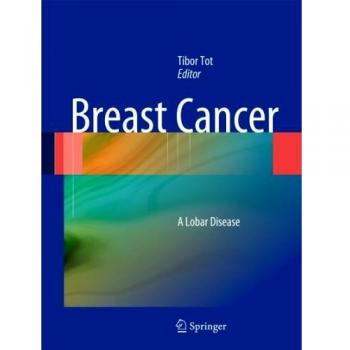 Breast Cancer: A Lobar Disease