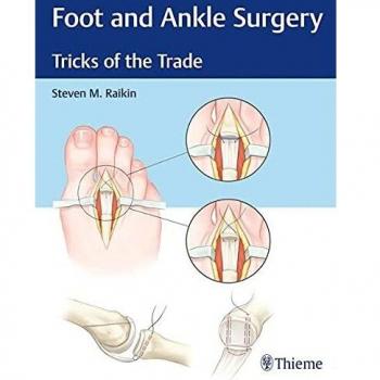 Foot And Ankle Surgery: Tricks Of The Trade