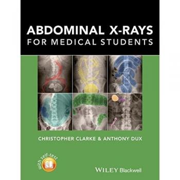 Clarke, Christopher: Abdominal X-rays for Medical Students
