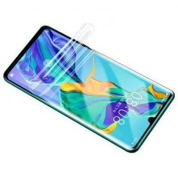 Capa de Protección Gel Completa Front y Back Huawei P10 Lite
