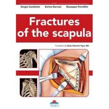 Fractures of the scapula. Ediz. illustrata