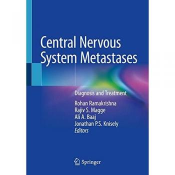Central Nervous System Metastases: Diagnosis and Treatment