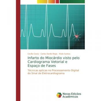 Infarto do Miocárdio visto pelo Cardiograma Vetorial e Espaço de Fases: Técnicas aplicas no Processamento Digital do Sinal de Eletrocardiograma