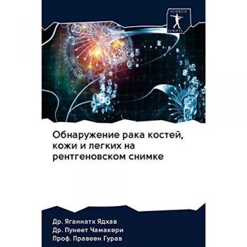 Обнаружение рака костей, кожи и легких на рентгеновском снимке