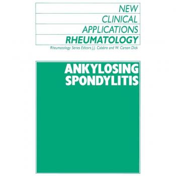 Ankylosing Spondylitis