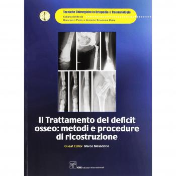 Il trattamento del deficit osseo: metodi e procedure di ricostruzione