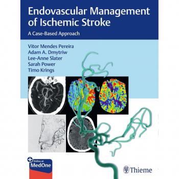 Endovascular Management of Ischemic Stroke