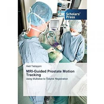 MRI-Guided Prostate Motion Tracking: Using Multislice to Volume Registration