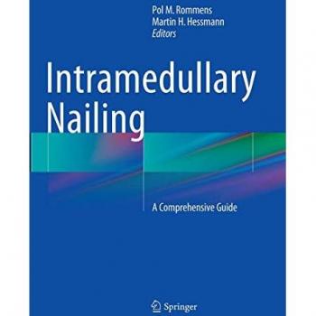 Intramedullary Nailing: A Comprehensive Guide