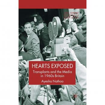 Hearts Exposed: Transplants and the Media in 1960s Britain
