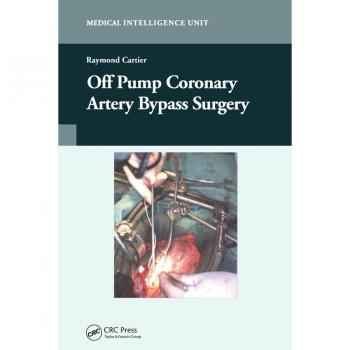Off-Pump Coronary Artery Bypass Surgery
