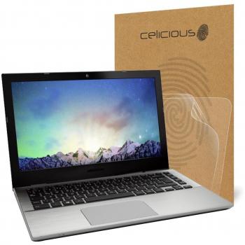 MatteGuard Celicious – 2‑Pack Screen Protector (Akoya S3409)