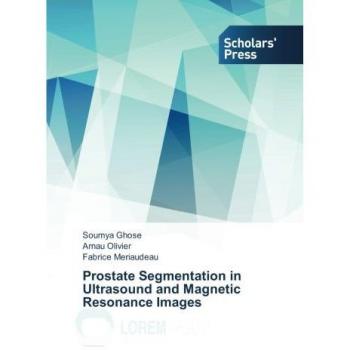 Prostate Segmentation in Ultrasound and Magnetic Resonance Images