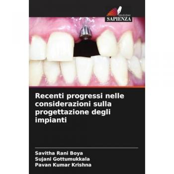 Recenti progressi nelle considerazioni sulla progettazione degli impianti