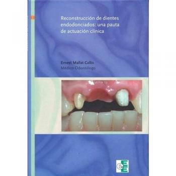 Reconstruccion de dientes endodonciados