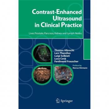 Contrast-Enhanced Ultrasound in Clinical Practice