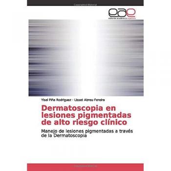Dermatoscopia en lesiones pigmentadas de alto riesgo clínico: Manejo de lesiones pigmentadas a través de la Dermatoscopia