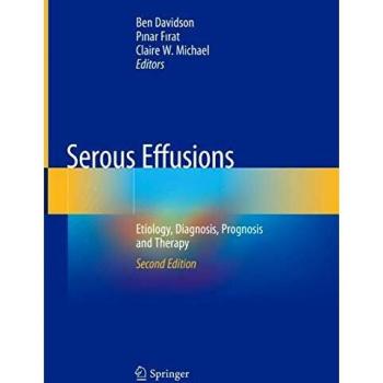 Serous Effusions: Etiology, Diagnosis, Prognosis and Therapy