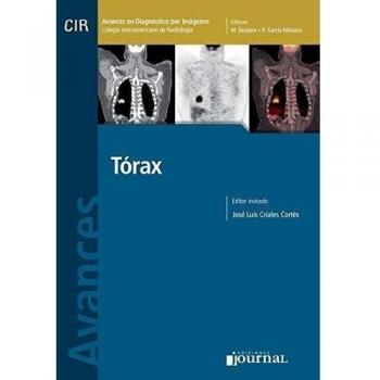 AVANCES EN DIAGNOSTICO POR IMAGENES. TORAX