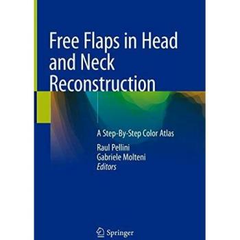 Free Flaps in Head and Neck Reconstruction