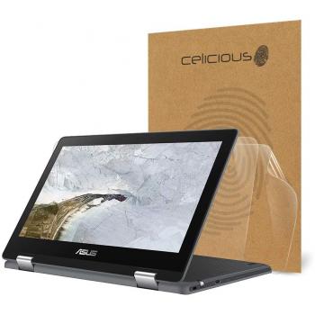 AquaGloss Vivid Protector – 2-Pack for ASUS Chromebook Flip C214
