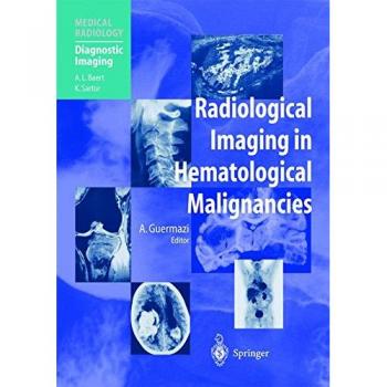 Radiological Imaging in Hematological Malignancies