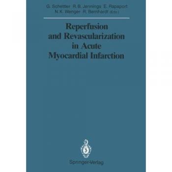 Reperfusion and Revascularization in Acute Myocardial Infarction