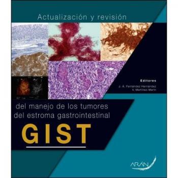 ACTUALIZACION Y REVISION DEL MANEJO DE LOS TUMORES DEL ESTROMA